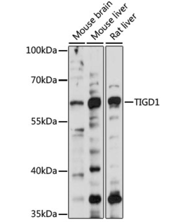 TIGD1 Rabbit Polyclonal Antibody