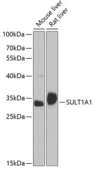 SULT1A1 Rabbit Polyclonal Antibody