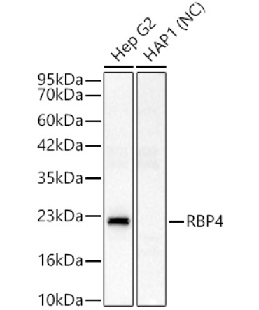 RBP4 Rabbit Polyclonal Antibody
