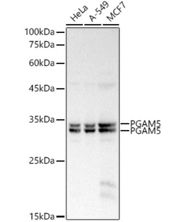 PGAM5 Rabbit Polyclonal Antibody