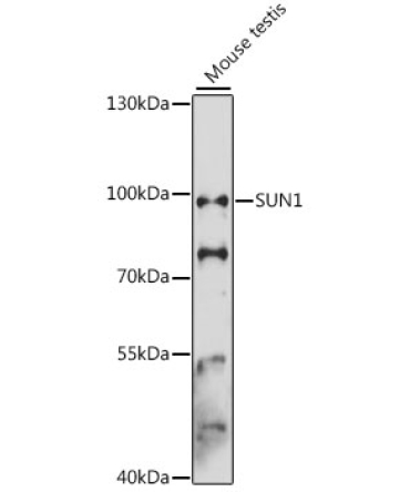 SUN1 Rabbit Polyclonal Antibody