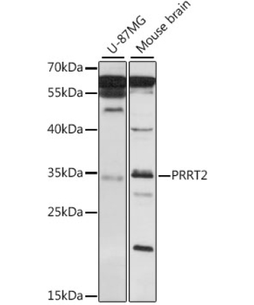 PRRT2 Rabbit Polyclonal Antibody