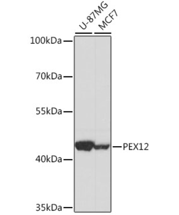 PEX12 Rabbit Polyclonal Antibody