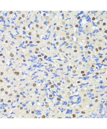 TRIM27 Rabbit Polyclonal Antibody