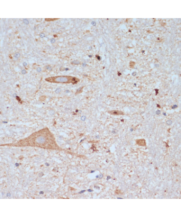 SLC18A3 Rabbit Polyclonal Antibody