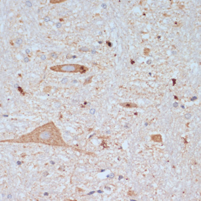 SLC18A3 Rabbit Polyclonal Antibody