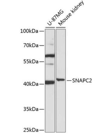 SNAPC2 Rabbit Polyclonal Antibody