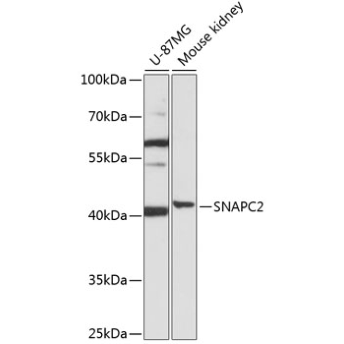 SNAPC2 Rabbit Polyclonal Antibody