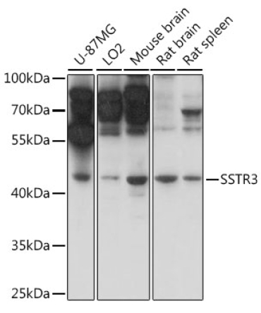 SSTR3 Rabbit Polyclonal Antibody