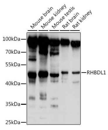 RHBDL1 Rabbit Polyclonal Antibody