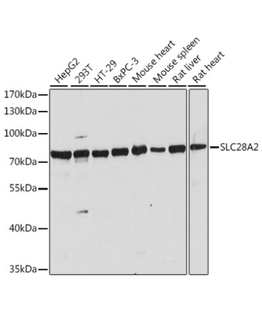 SLC28A2 Rabbit Polyclonal Antibody