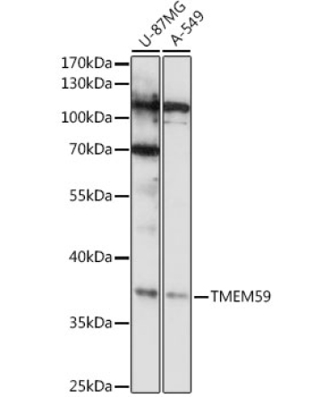 TMEM59 Rabbit Polyclonal Antibody