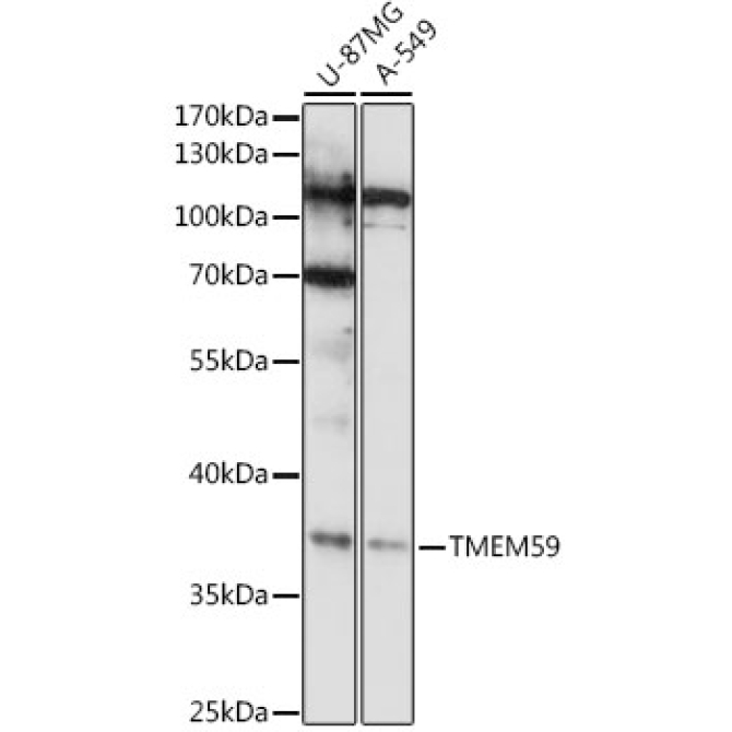 TMEM59 Rabbit Polyclonal Antibody
