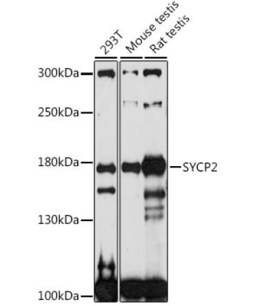 SYCP2 Rabbit Polyclonal Antibody