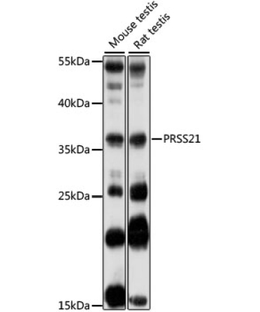 PRSS21 Rabbit Polyclonal Antibody