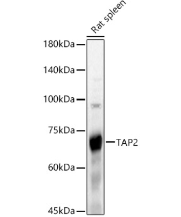 TAP2 Rabbit Polyclonal Antibody