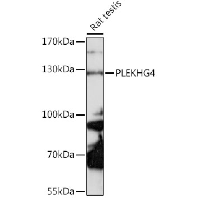 PLEKHG4 Rabbit Polyclonal Antibody
