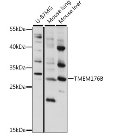 TMEM176B Rabbit Polyclonal Antibody