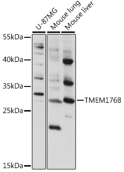 TMEM176B Rabbit Polyclonal Antibody