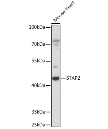 STAP2 Rabbit Polyclonal Antibody