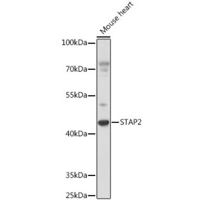 STAP2 Rabbit Polyclonal Antibody