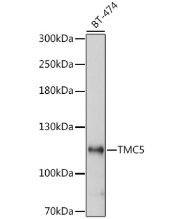 TMC5 Rabbit Polyclonal Antibody