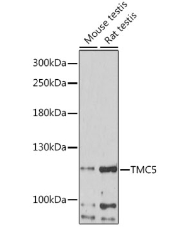 TMC5 Rabbit Polyclonal Antibody