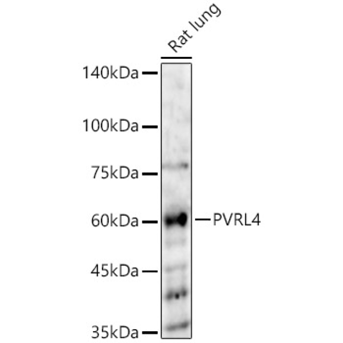 PVRL4 Rabbit Polyclonal Antibody