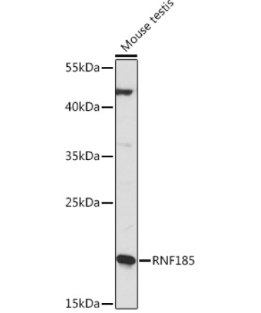 RNF185 Rabbit Polyclonal Antibody