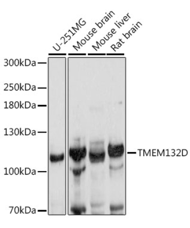 TMEM132D Rabbit Polyclonal Antibody