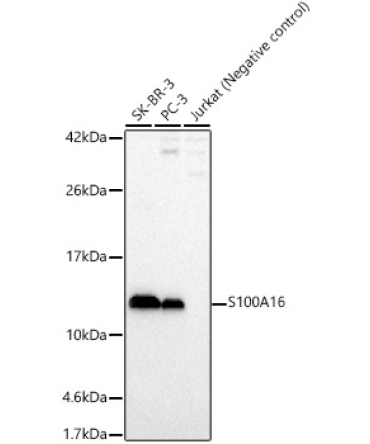 S100A16 Rabbit Polyclonal Antibody