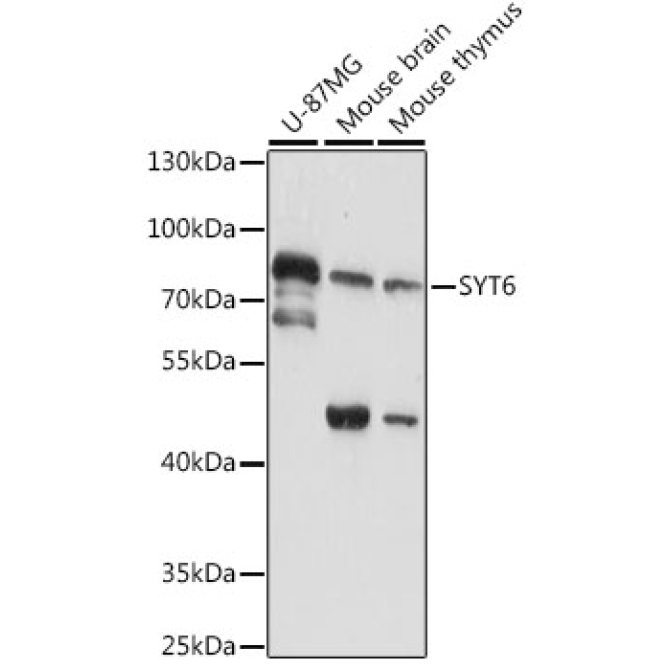 SYT6 Rabbit Polyclonal Antibody