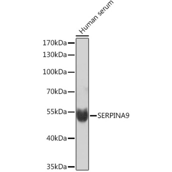 SERPINA9 Rabbit Polyclonal Antibody