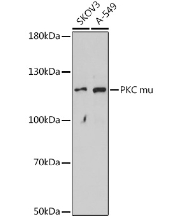 PKC mu Rabbit Polyclonal Antibody