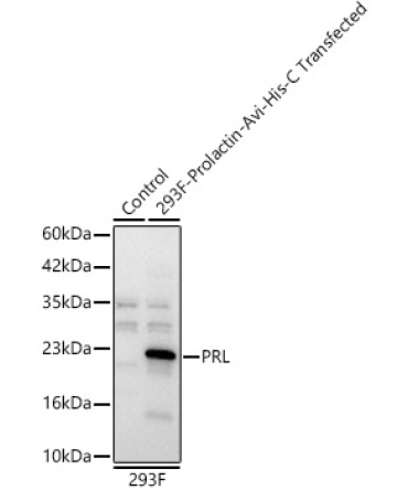 PRL Rabbit Polyclonal Antibody