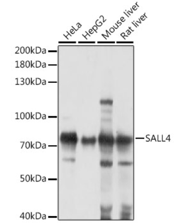 Sall4 Rabbit Polyclonal Antibody