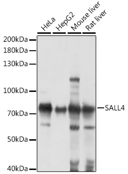 Sall4 Rabbit Polyclonal Antibody