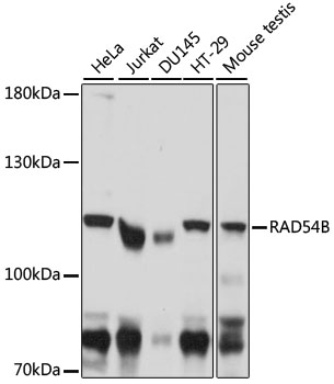 RAD54B Rabbit Polyclonal Antibody
