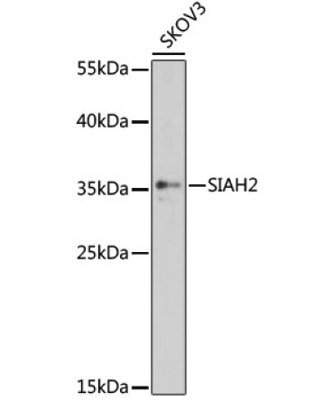 SIAH2 Rabbit Polyclonal Antibody