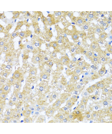 TGFB2 Rabbit Polyclonal Antibody