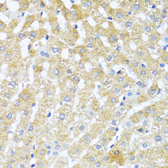 TGFB2 Rabbit Polyclonal Antibody