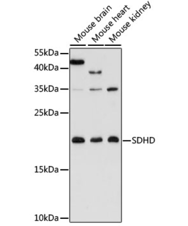 SDHD Rabbit Polyclonal Antibody