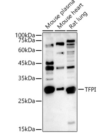 TFPI Rabbit Polyclonal Antibody