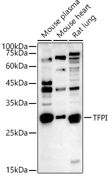 TFPI Rabbit Polyclonal Antibody