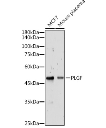 PLGF Rabbit Polyclonal Antibody