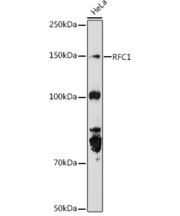 RFC1 Rabbit Polyclonal Antibody
