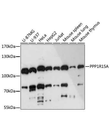 PPP1R15A Rabbit Polyclonal Antibody