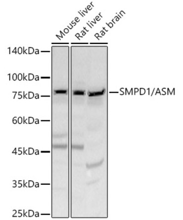 SMPD1 / ASM Rabbit Polyclonal Antibody