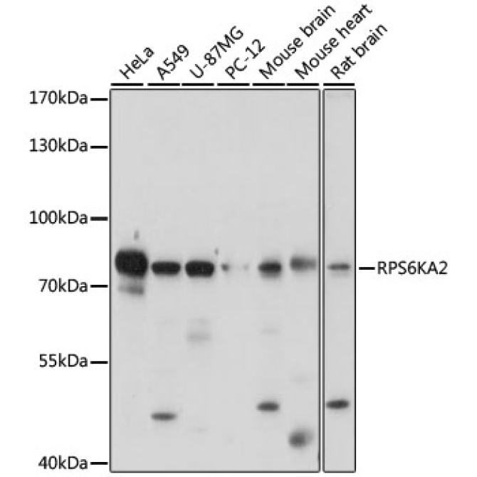 RPS6KA2 Rabbit Polyclonal Antibody