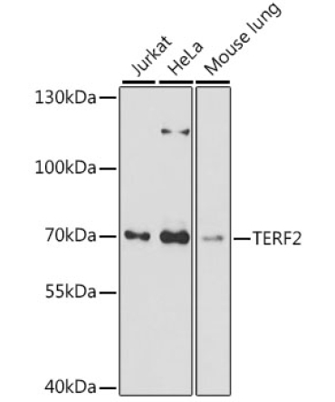 TERF2 Rabbit Polyclonal Antibody